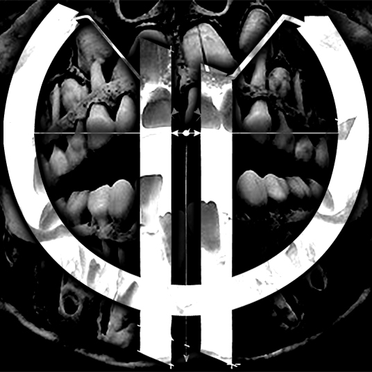 Album artwork for nemesis