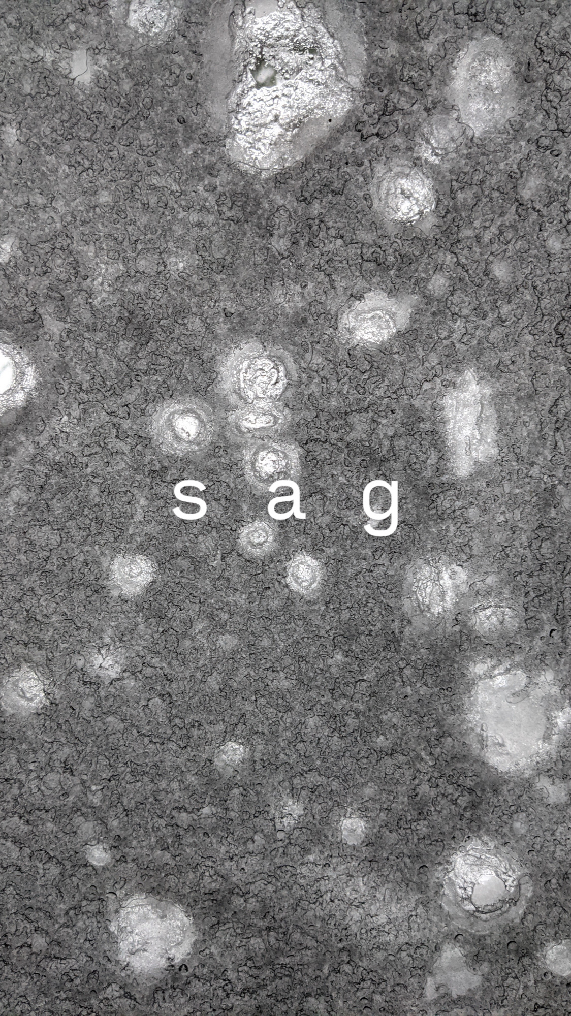 s a g